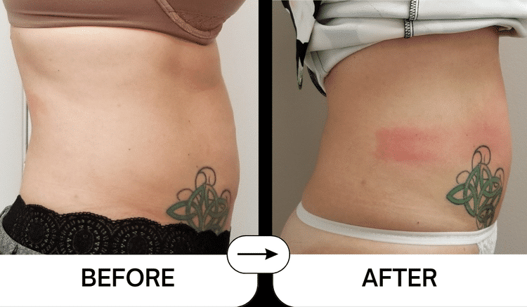 VELASHAPE2